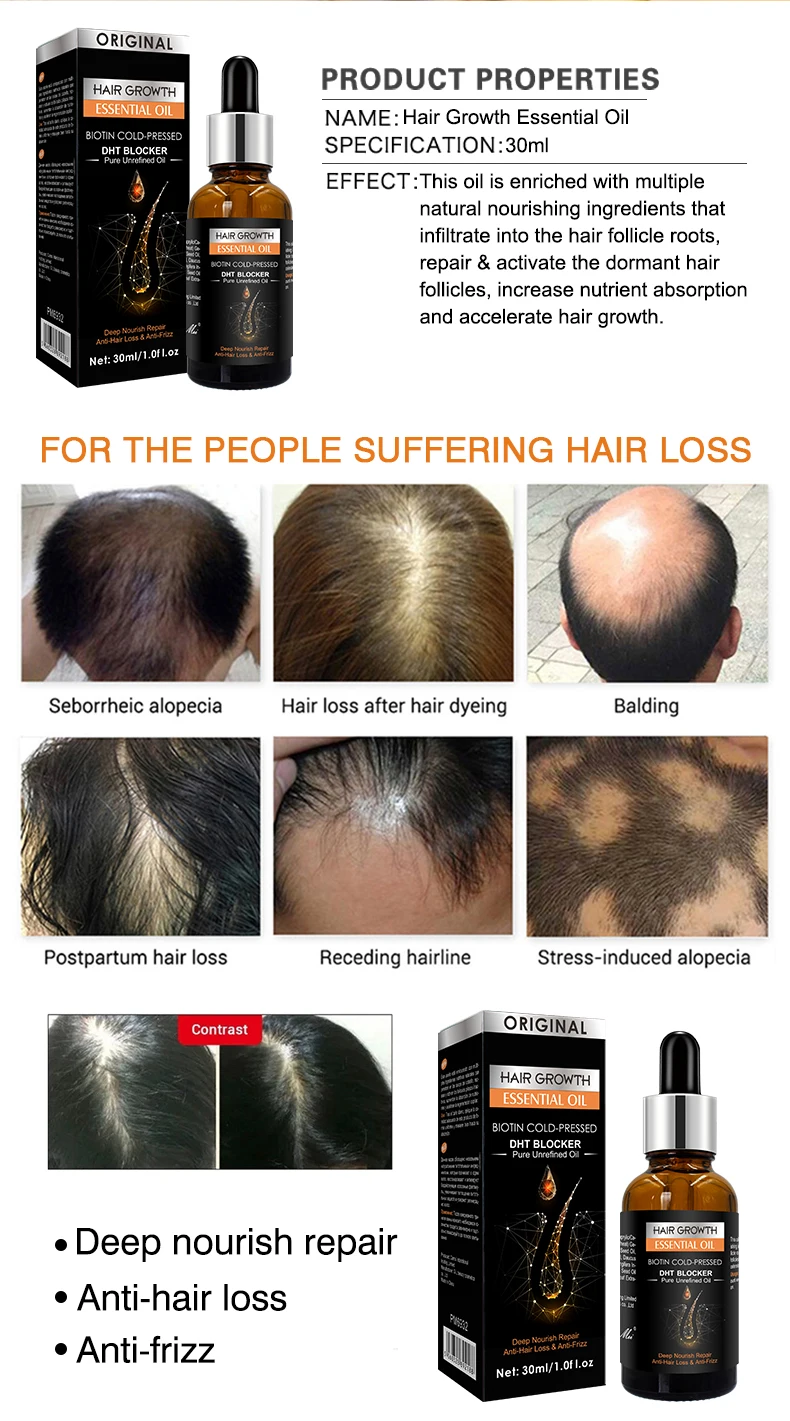 New Original Anti Hair Loss Treatment Fast Hair Growth Serum for Damage Hair