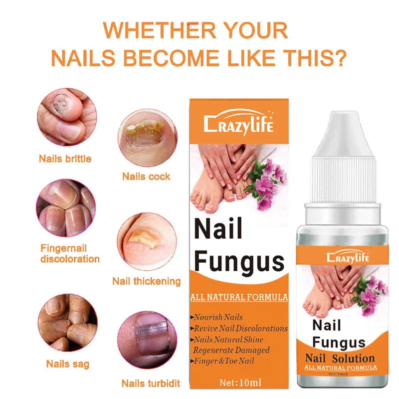 Fungal Nail Treatment Oil Foot Repair Essence Toe Nail Fungus Removal