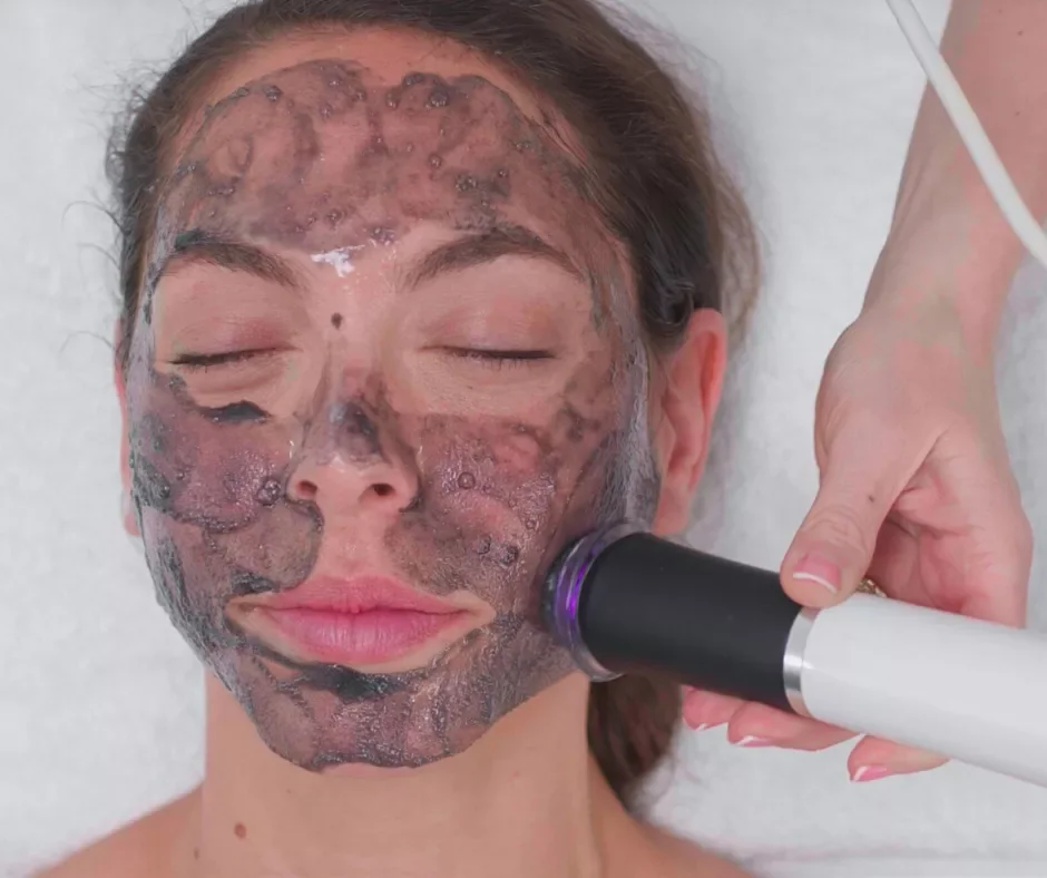 High Quality Oxygen Jet Facial Machine with CO2 Bubble Exfoliation Musical Function Model F201D (China) Eye Massager
