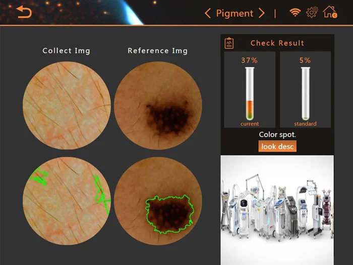 Professional Face Skin Analyzer Machine Portable Skin Scanner Intelligent Skin Analysis Machine