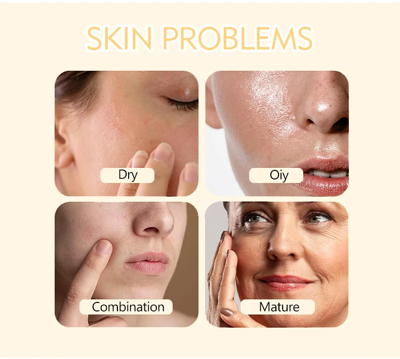 Glycolic Acid Toner Face Brightening Pore Shrinking Reduce Fine Lines Dead Skin Exfoliating Skin Toner (New)