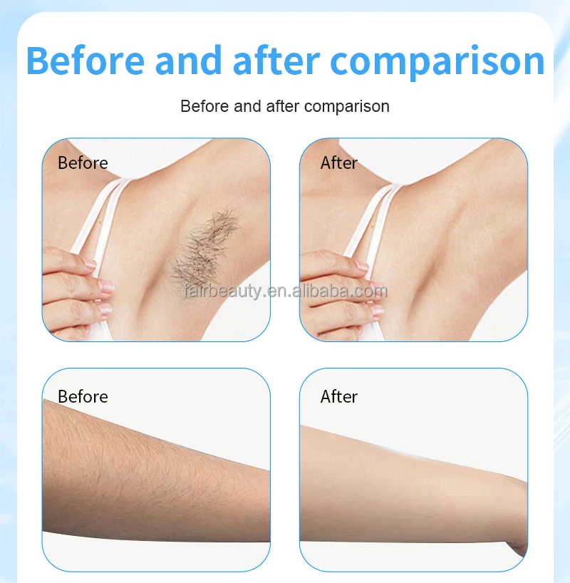 Professional Accessory Kit