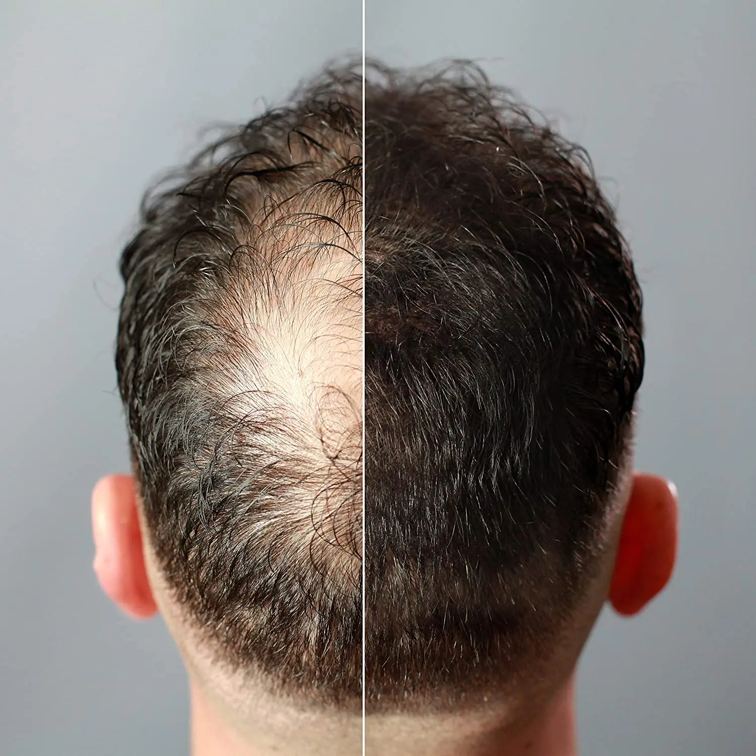 dooisek human hair loss male thinning hair fibers bulk