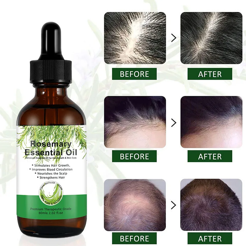 Factory Custom Rosemary Oil Hair Growth Organic Anti Dandraf Rosmary ...