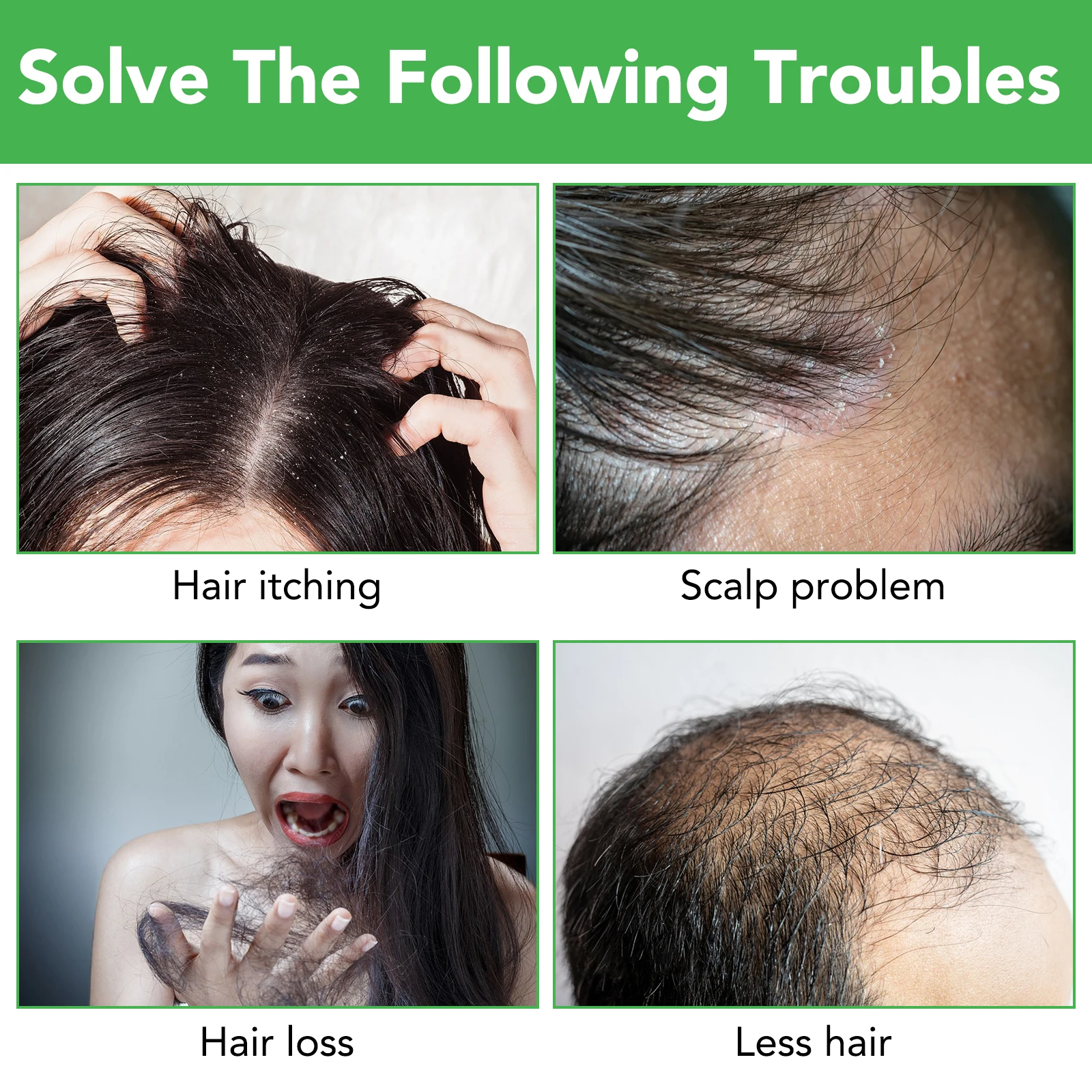 Oem 100 Pure Natural Organic Rogaine Hair Growth Care Set Antihair