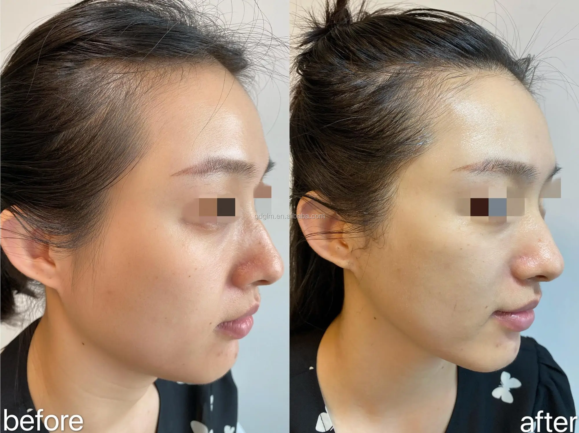 before and after 2