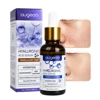 Hyaluronic Acid