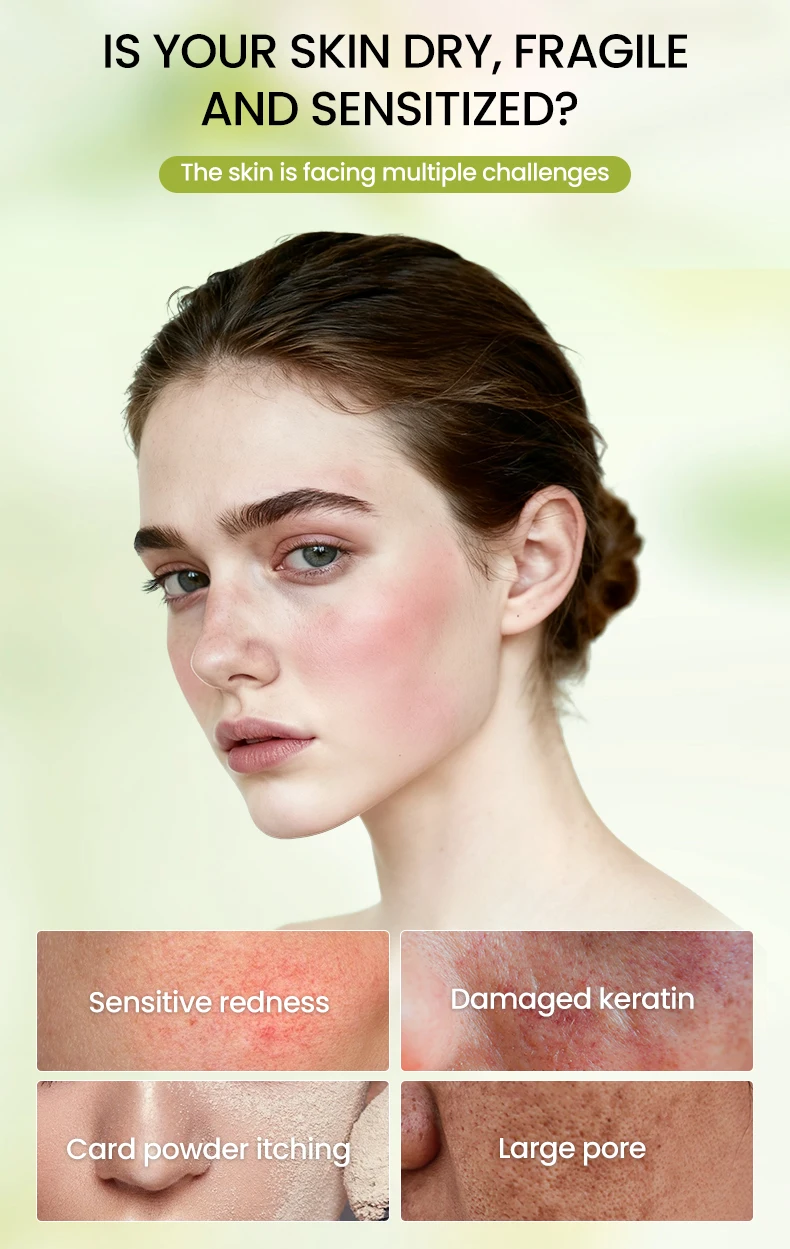 Icesea Australia Chamomile Facial Skin Care Set for Sensitive Skin-Moisturizer Soothing Redness & Dryness Relief(pic1)