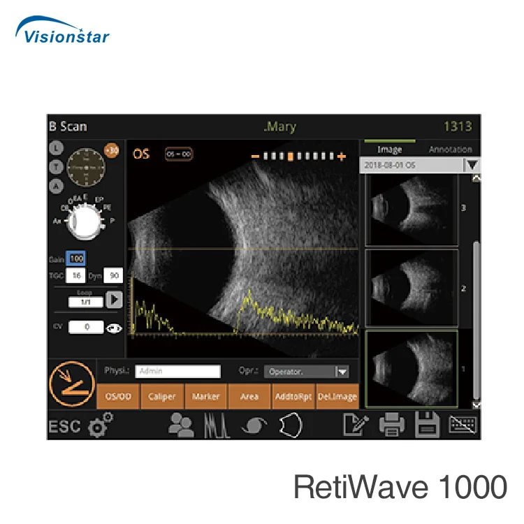 RetiWave-1000 Ophthalmology AB Scan Ultrasound Touch Screen Portable Ophthalmic a B Scan Machine