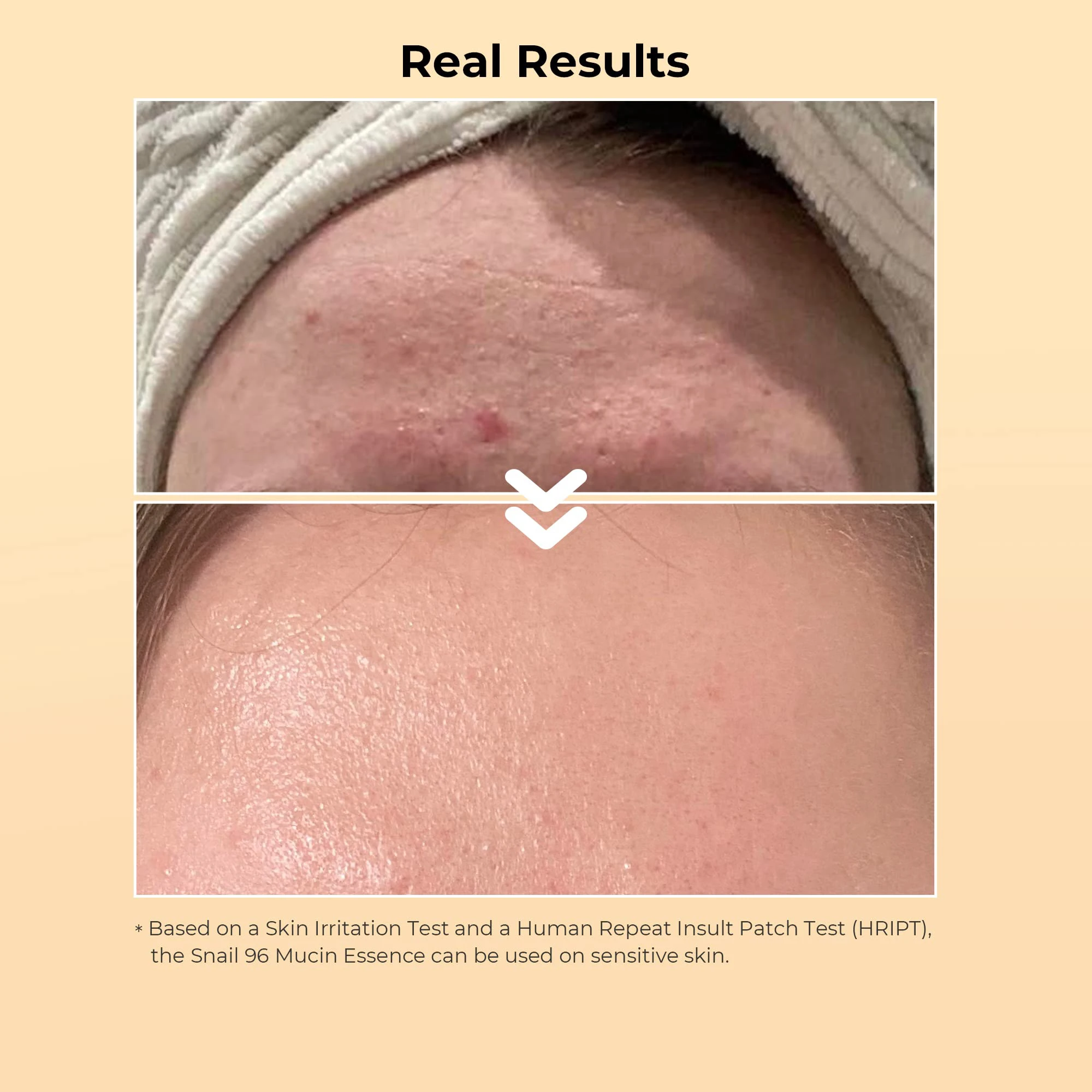 AiXin Private Label 100ML Moisturizing Soothe Damaged Skin Advanced Snail 96 Mucin Power Essence Snail Serum