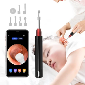 Smart otoscope for ear wax cleaning baby care personal care hair checking skin checking and Pet health checking