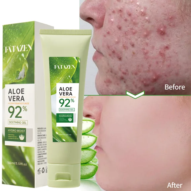 Private Label Facial Care younger Cleanser for acne-prone skin Repairs dry skin Improves  acne scars Aloe Vera Soothing Gel