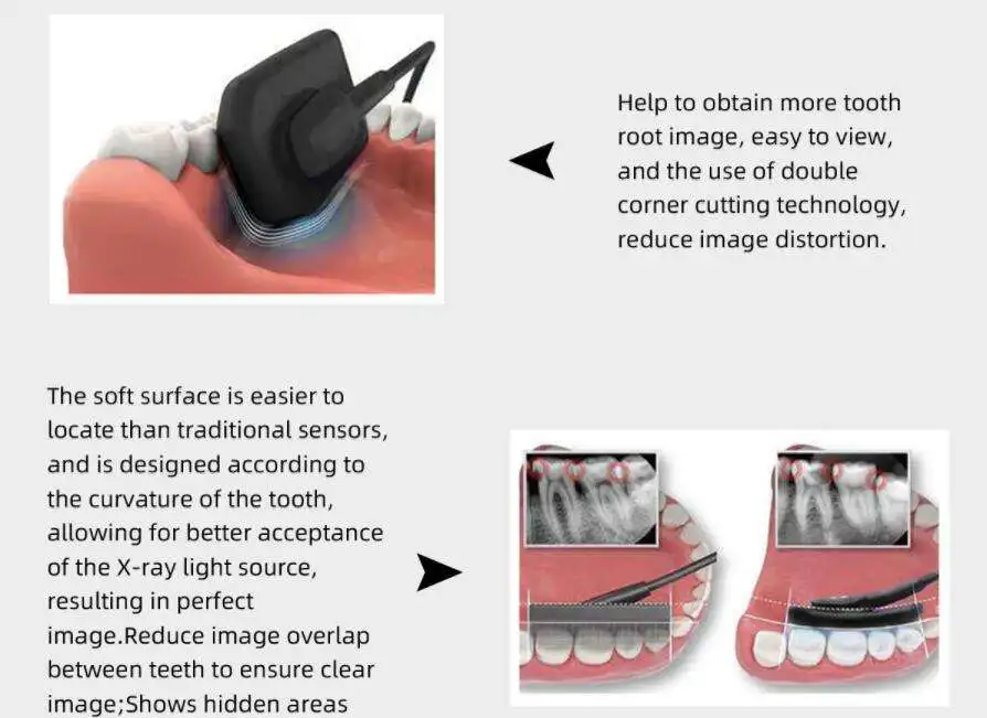 Latest Portable Digital X-Ray RVG Sensor for Teeth Budget Price Dental Imaging System