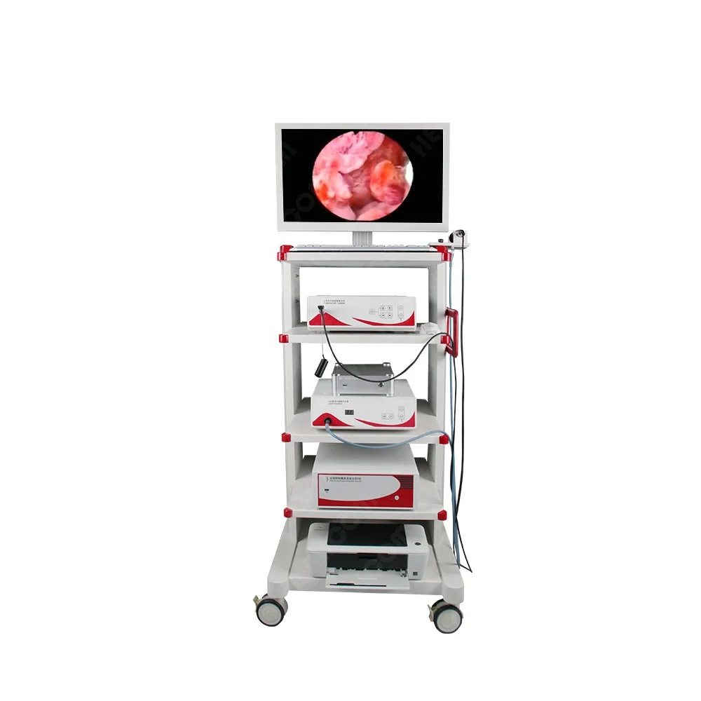 Endoscopy Equipment Gynecological Hysteroscopy Tower Complete Set