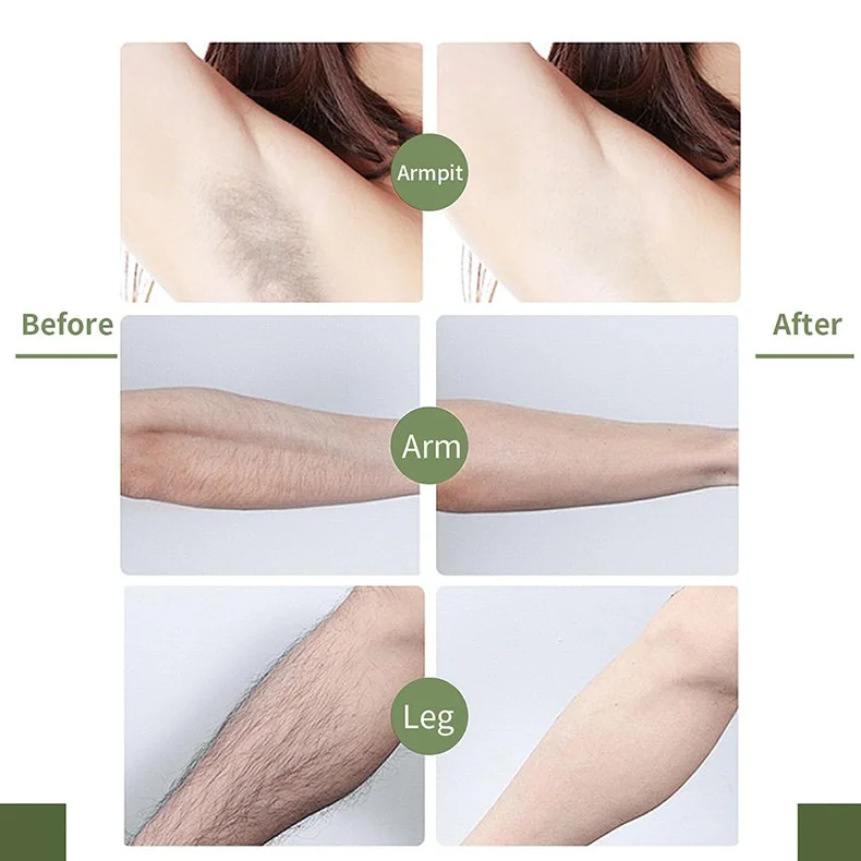 Convenient Use Oem All Skin Types Wax Strips Body Arm Armpit Leg Bikini Line Face Hair Removal Wax Strips Paper