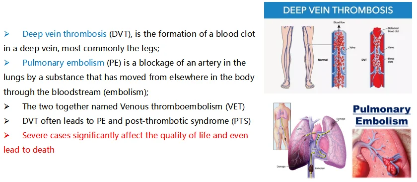 Intermittent DVT Deep Vein Thrombosis Prophylaxis Compression Therapy boots DVT prevention dvt pump machine