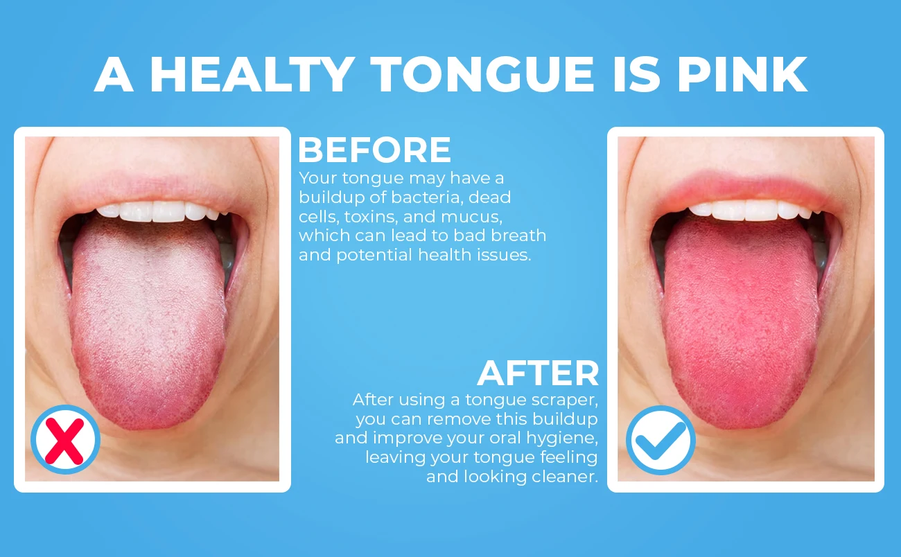 Hot Sales Premium 100 Rose Gold Copper Metal U Shaped Tongue Scraper