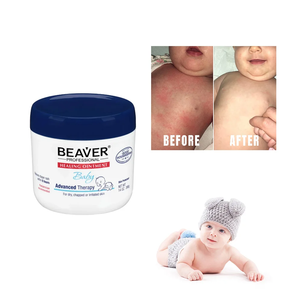 Фирменный натуральный детский лосьон от зуда, органическая детская восстанавливающая мазь для чувствительной сухой кожи, крем для подгузников, сыпи