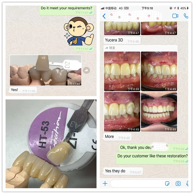 Yucera 95mm UT White Dental Zirconia Block for Grinding Machine for Dental Laboratory Use