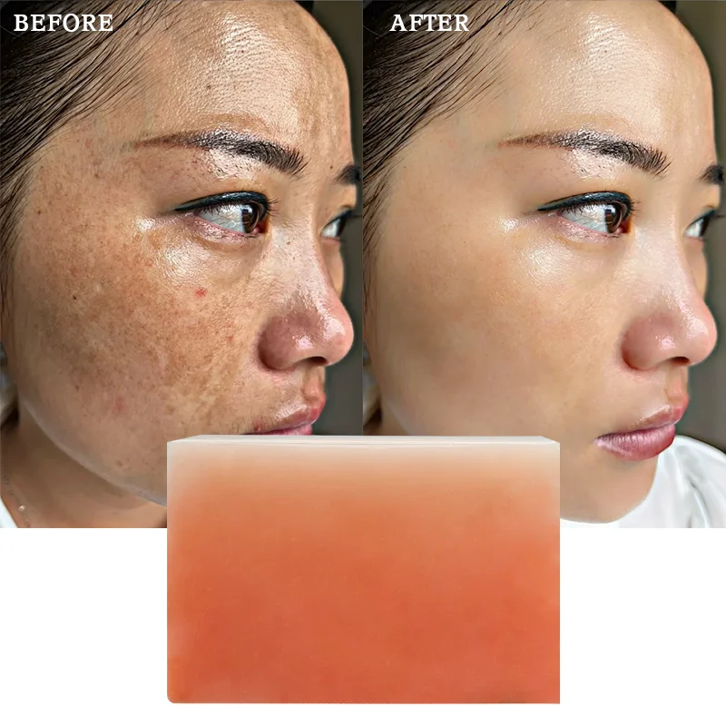 Private Label L-glutathione Skin Brightening Lightening Bath Bleaching Body Face Whitening Kojic Acid Soap For Dark Skin