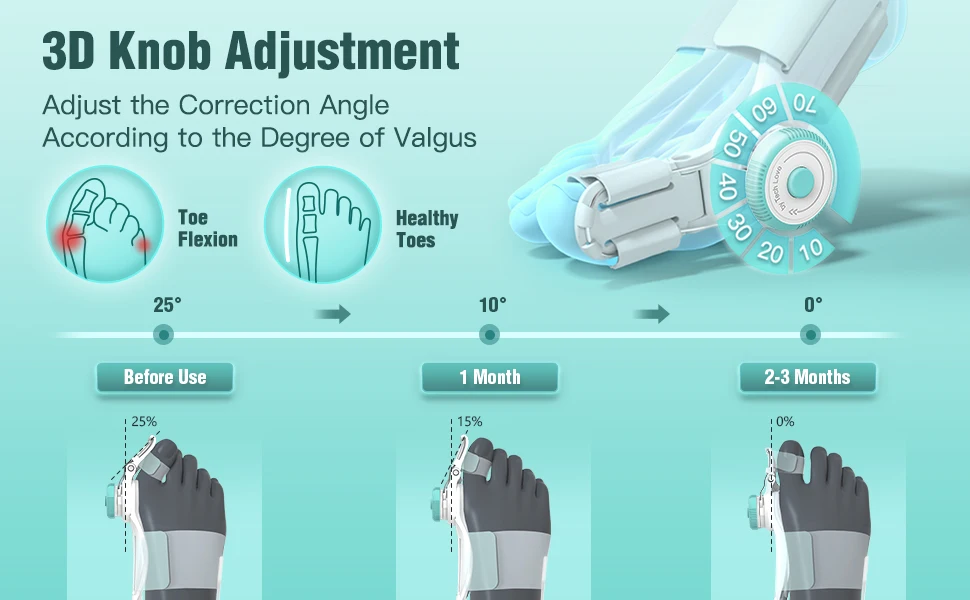 Tech Love Adjustable Bunion Corrector Hallux Valgus Brace Big Toe