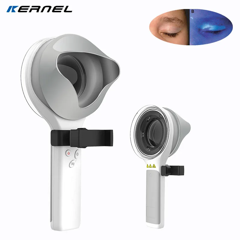DermLiTe UV Light LED Wood Lamp Facial Skin Analysis Vitiligo Diagnosis Wood's Lamp Examination Kernel KN-9000B for Medical USE