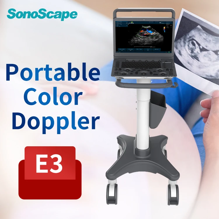 SonoScape E3 Cardiac Vascular Digital Color Doppler Portable Ultrasound Machine