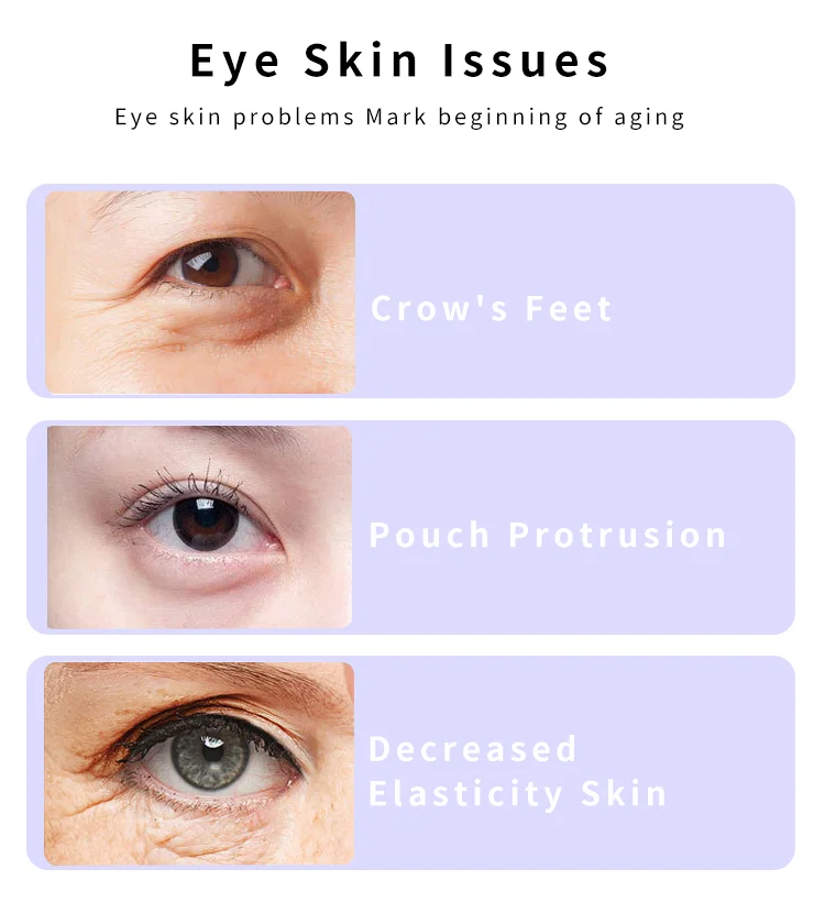 Rf Infra Red Beauty Facial Wand Blue Light Health And Beauty Magic