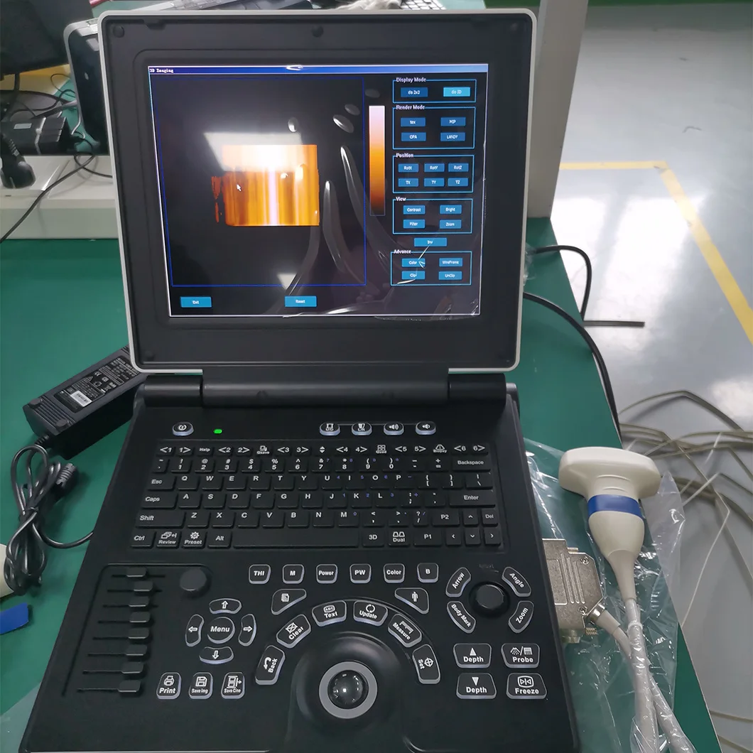 Medical Diagnostic Equipment Cheap Portable Laptop Human Color Doppler Ultrasound Scanner