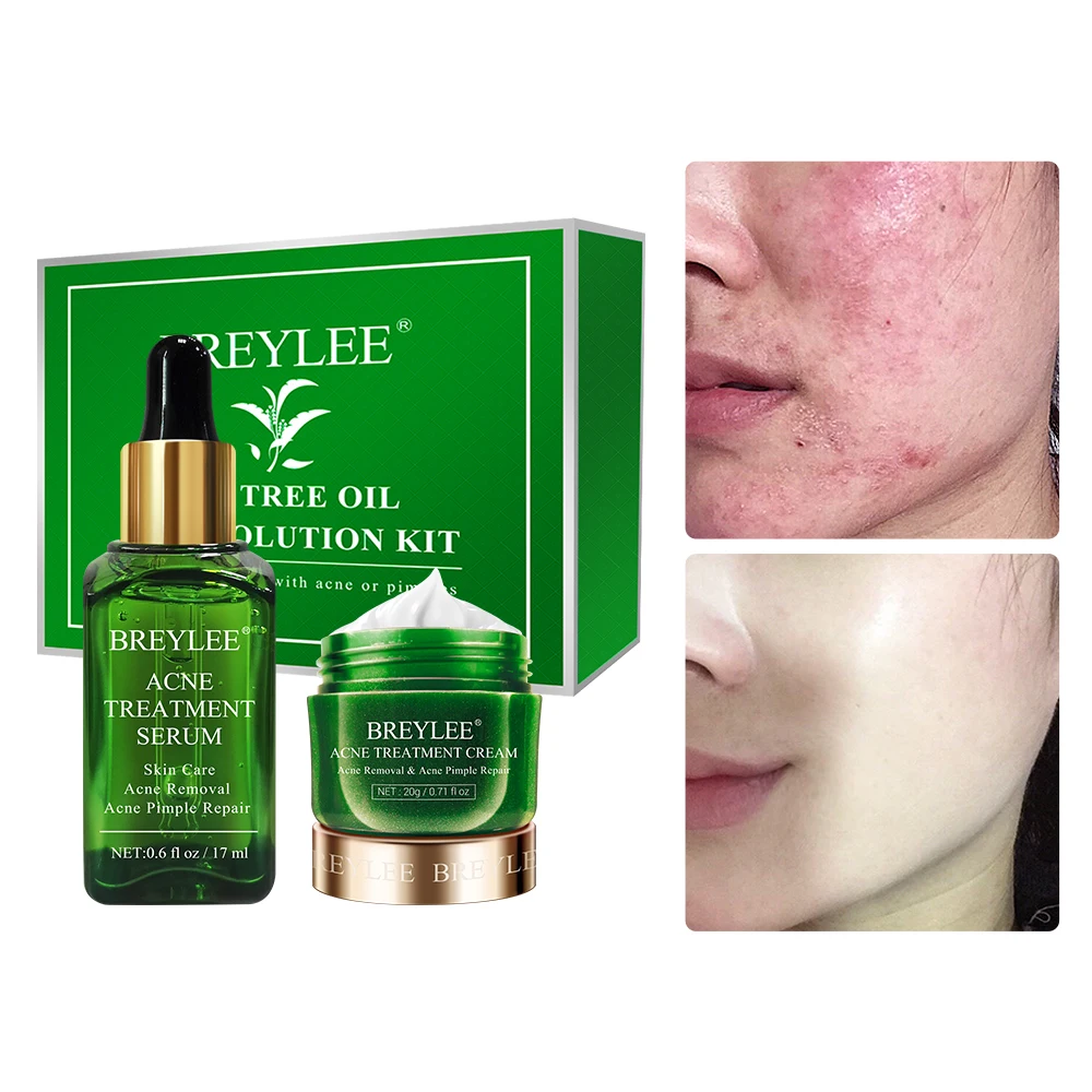 BREYLEE OEM Tea Tree Essential Oil Acne Skin Care Set Anti Acne Face Cream Acne Removal Serum