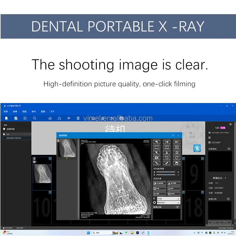 Dental Xrays Machine With Sensor Wireless Handheld Intraoral Digital Dental X Ray Machine With