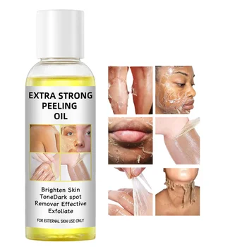 Custom Logo Extra strong peeling oil face and body yellow peeling lotion for dark knuckle and scars whitening