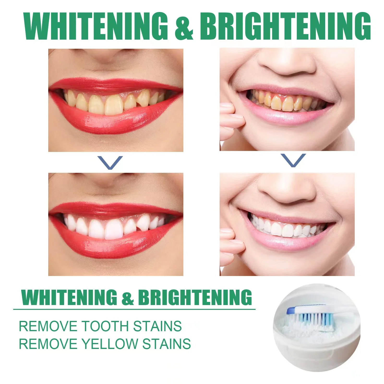 Eelhoe Other Teeth Whitening Accessories Professional Easy White Teeth
