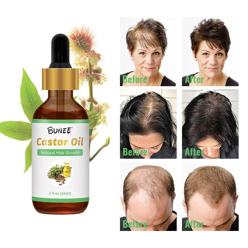 Best Organic Private Label Hair Growth Serum Oil Vitamins Hair Growth Oil -  Buy Private Label Hair Growth Serum,Hair Growth Serum,Hair Growth Products  For Black Women Product on 