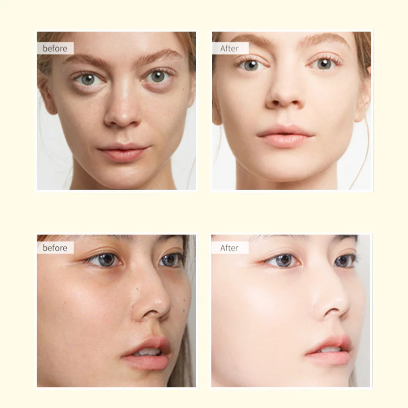 glutathione skin color Glowing, Not Whitening: The Glutathione Myth Debunked – Setu Nutrition main image 0