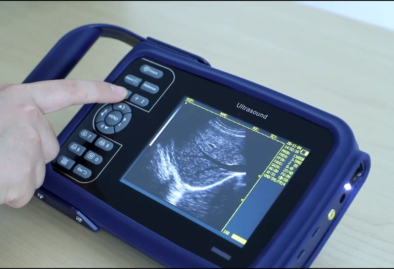Mobile Handheld Vet Ultrasound Machine Veterinary Ultrasound Ultrasonido Portatil