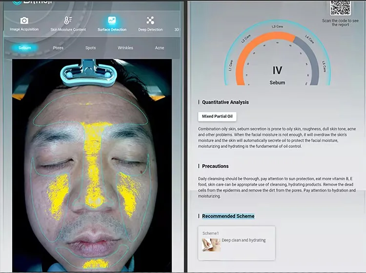 Skin Scope Analyzer 8 Spectral Imaging Technology Skin Analyzer Machine ...