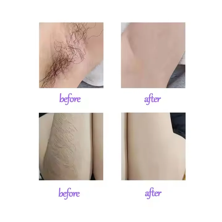 Private Label Hiar Removal 4.5X9Cm Cold Wax Strip Wax Paper Depilatory Wax Strip Suitable for All Skin Types