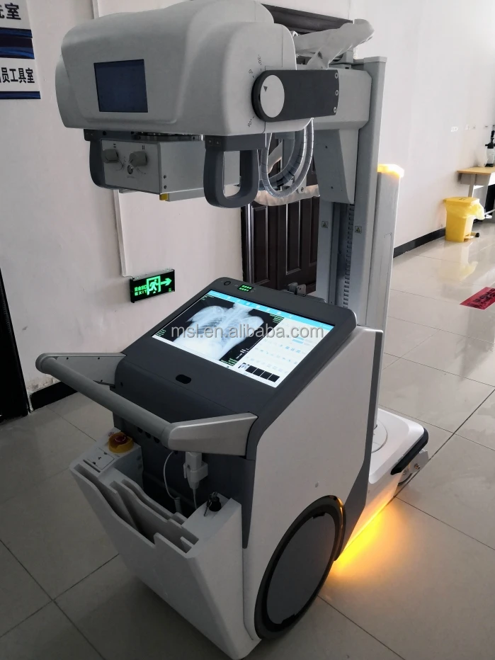 630ma X Ray Digital Machine/dr Digital X Ray Machine Price Buy Flat