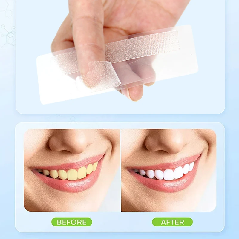 Dissolving Pap Charcoal White Strips Custom Tooth Teeth Whitening