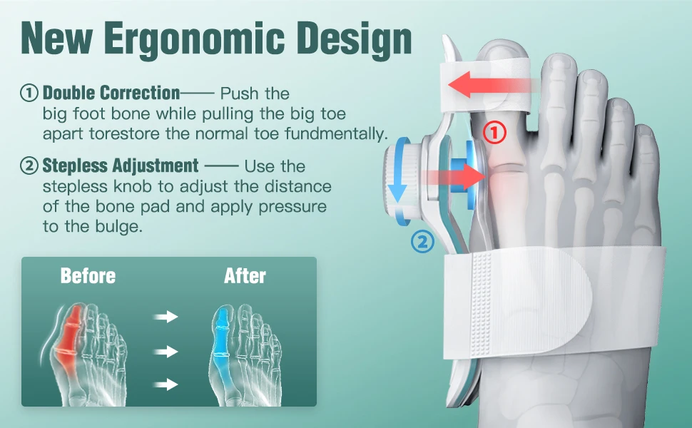 Tech Love Adjustable Orthopedic Straighten Splint Support Separator