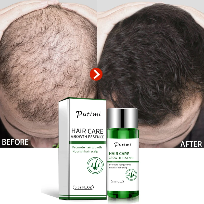 Protect and Nourish Your Hair with Hair Serum  Your Guide to the 15 Best Hair  Serums for Men and Everything You Need to Know About Hair Serums for Men  2020