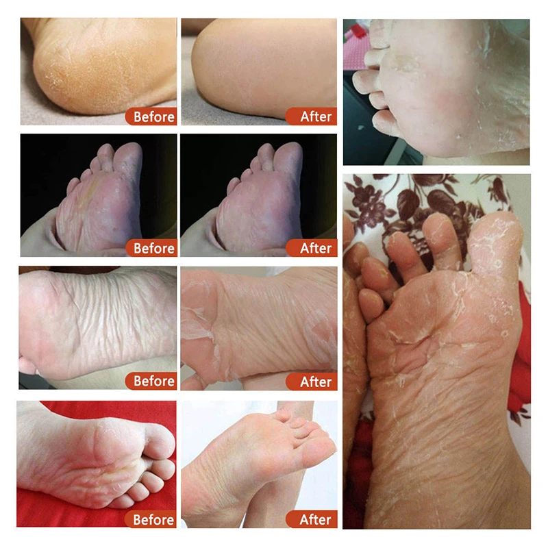 Factory Wholesale 40g Foot Care Prevents Dryness Soften Cutin Lavender & VC Exfoliating Foot Peel Mask