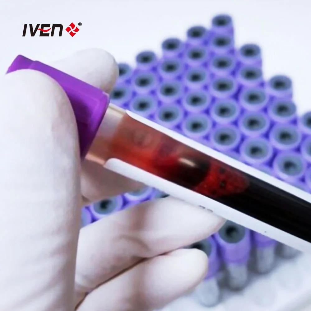 Асептическая одноразовая трубка для сыворотки крови интегрированная забора машина сбора