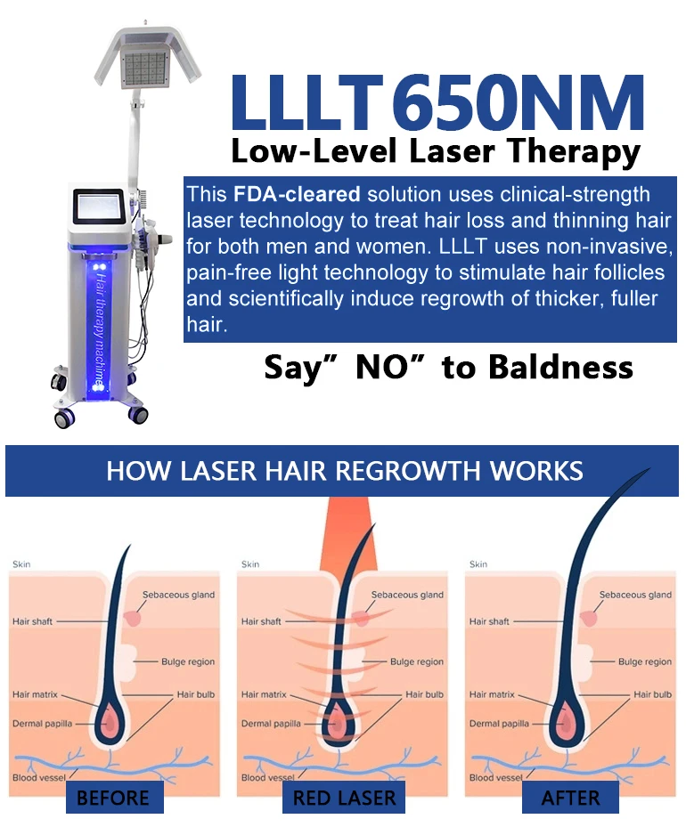 High-Efficiency Laser Beauty Machine for Hair Growth Treatment with Bio-Energy Low Level Laser Therapy Diode Laser 650nm