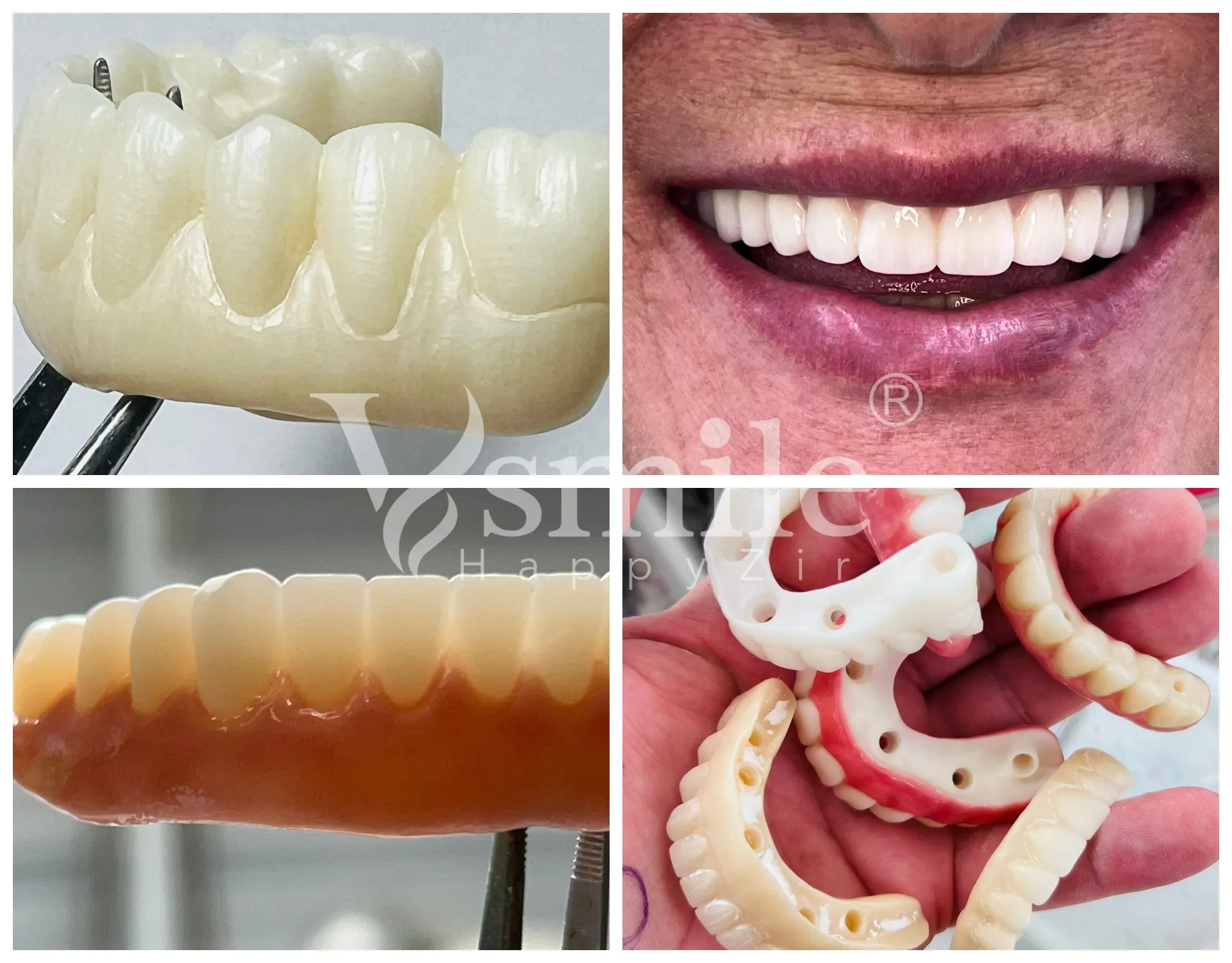 Preshade Vsmile High Translucent Plus Color Preshade 3D Pro Zirconia Block CE ...