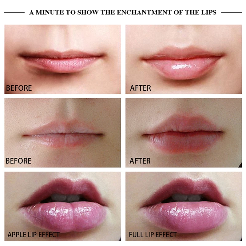 Apple & Full Two Types Lip Plumper Enhancer Lip Enhancer Machine