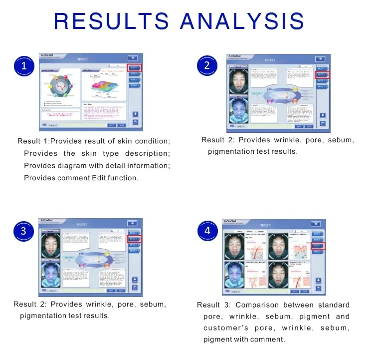 Portable 3D Skin Analyzer Equipment Face Testing Mirror with EU IT JP ...