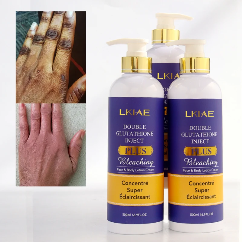 best glutathione injections wellington fl NutriGLOW: IV Glutathione Drip for Skin Beauty Treatment