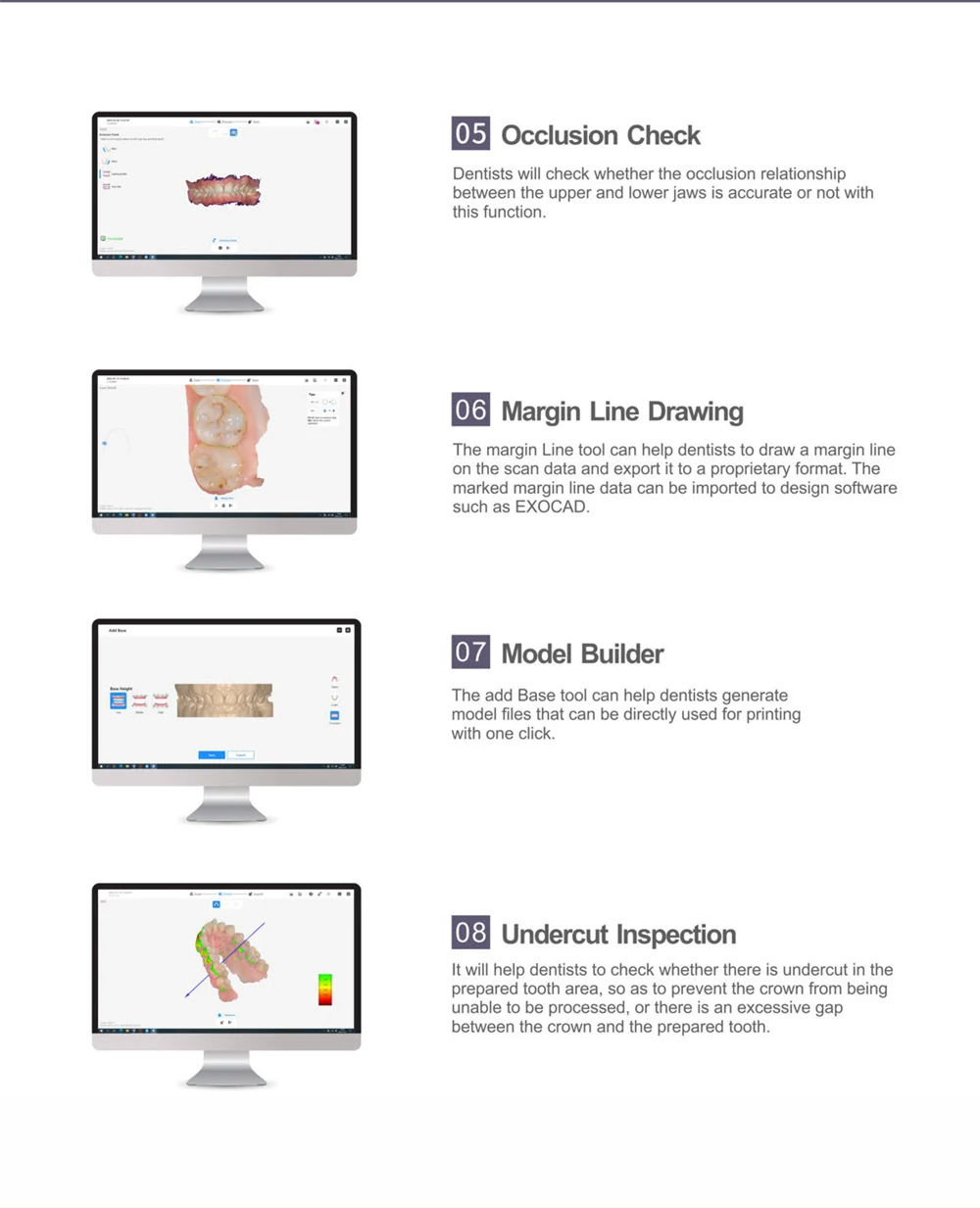 Primecera Oral 3d Scanner Dental Cad Cam Digital Intra Oral Scanner ...